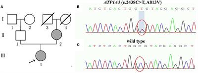 ATP1A3 mutation in rapid-onset dystonia parkinsonism: New data and genotype-phenotype correlation analysis